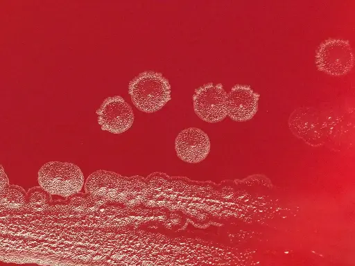 [SK-1511] rAAV-RAM-d2TTA-TRE-hChR2(C128S D156A)-EYFP