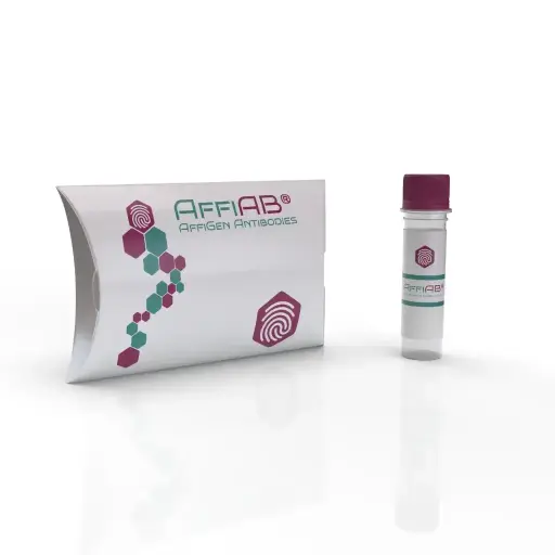 [ABF5231] AQP1 Antibody